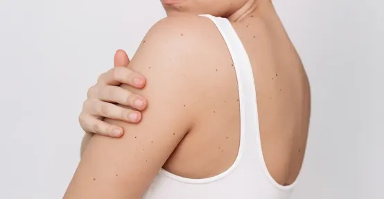 HeiQ Skin Care™ Image